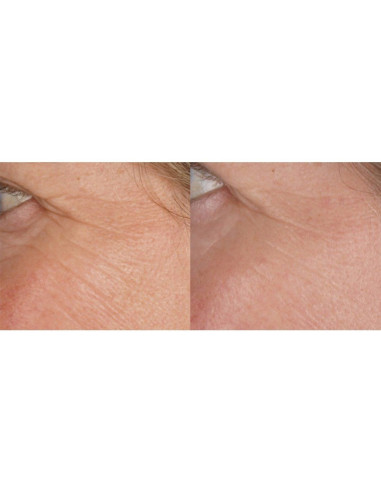 Aparat antirid Silkn FaceFX – tehnologie LED pentru îngrijirea tenului