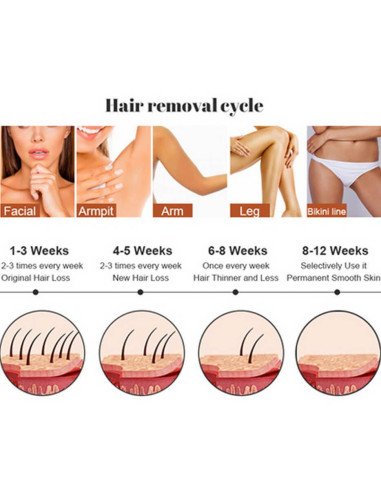 Aparat Epilare Definitiva cu Dioda Laser 808nm