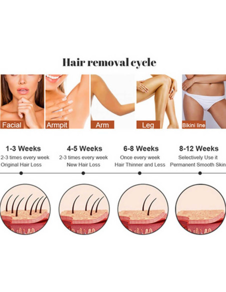 Aparat Epilare Definitiva cu Dioda Laser 808nm